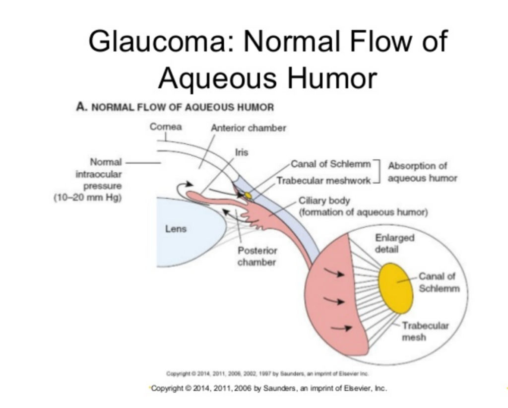 aqueous flow glaucoma
