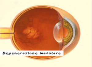 degenerazione-maculare-1