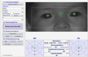 oculistica-pediatrica