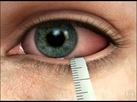 Schirmer test