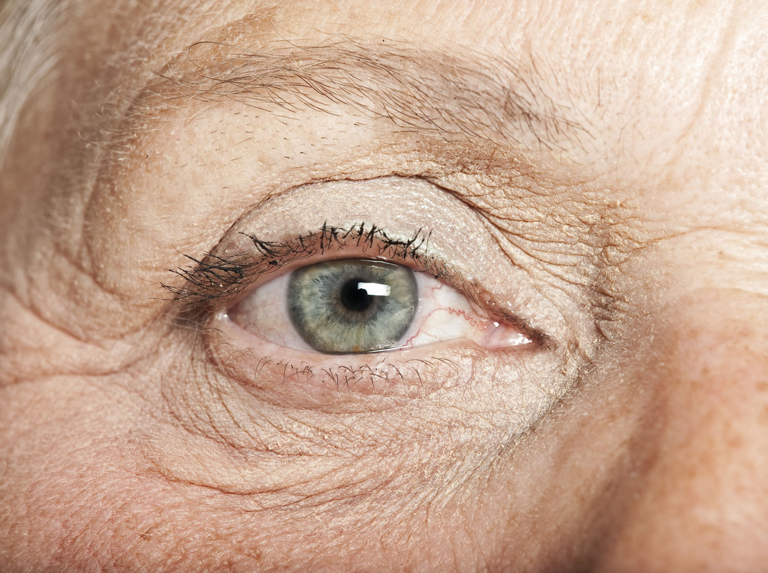 old people glaucoma